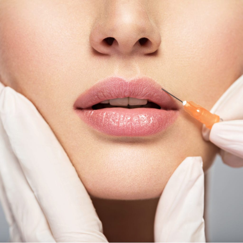 The Dos and Don'ts of Preparing for a Filler Treatment