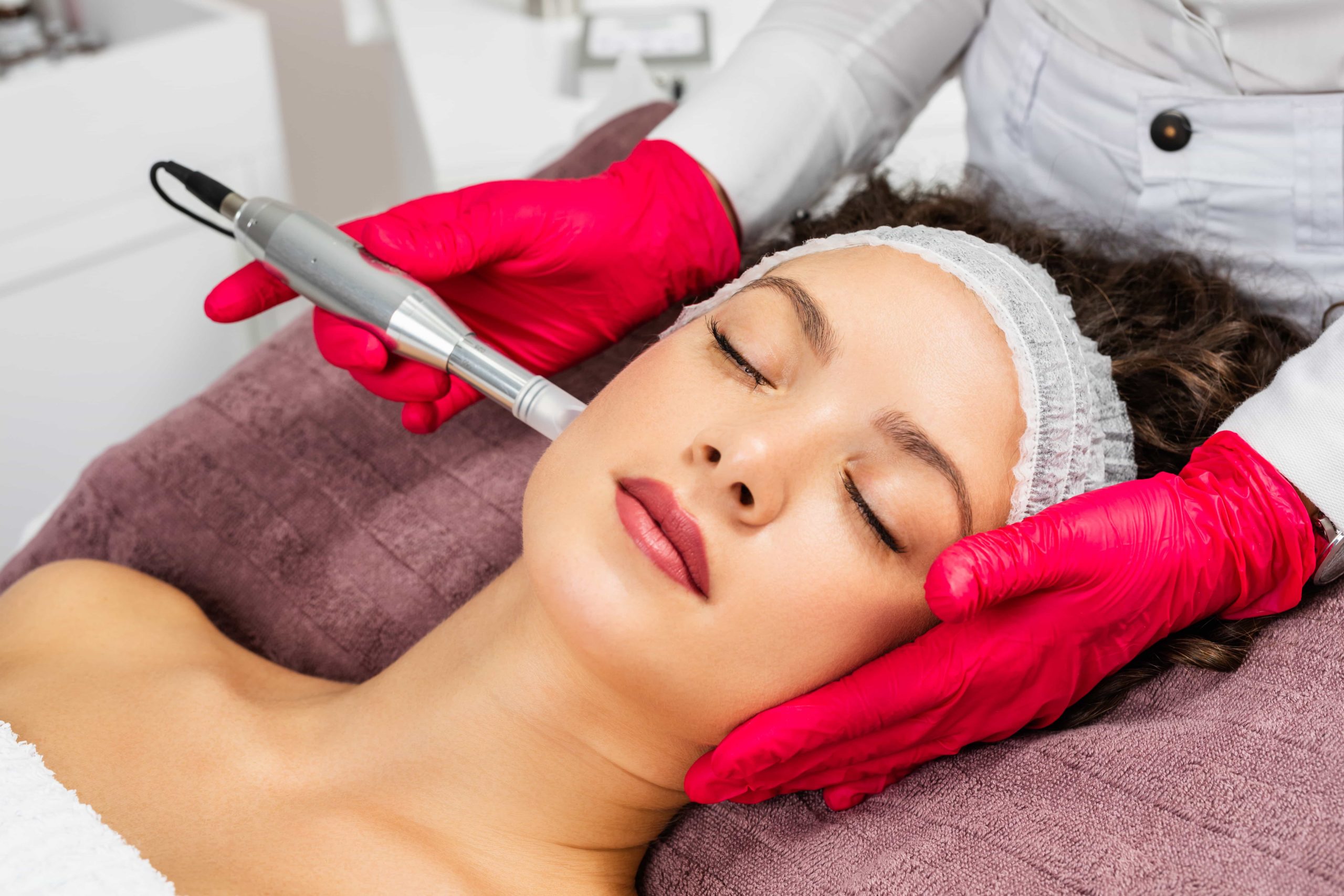 PRP Microneedling | Savvy Beauty and Wellness | Norco, CA